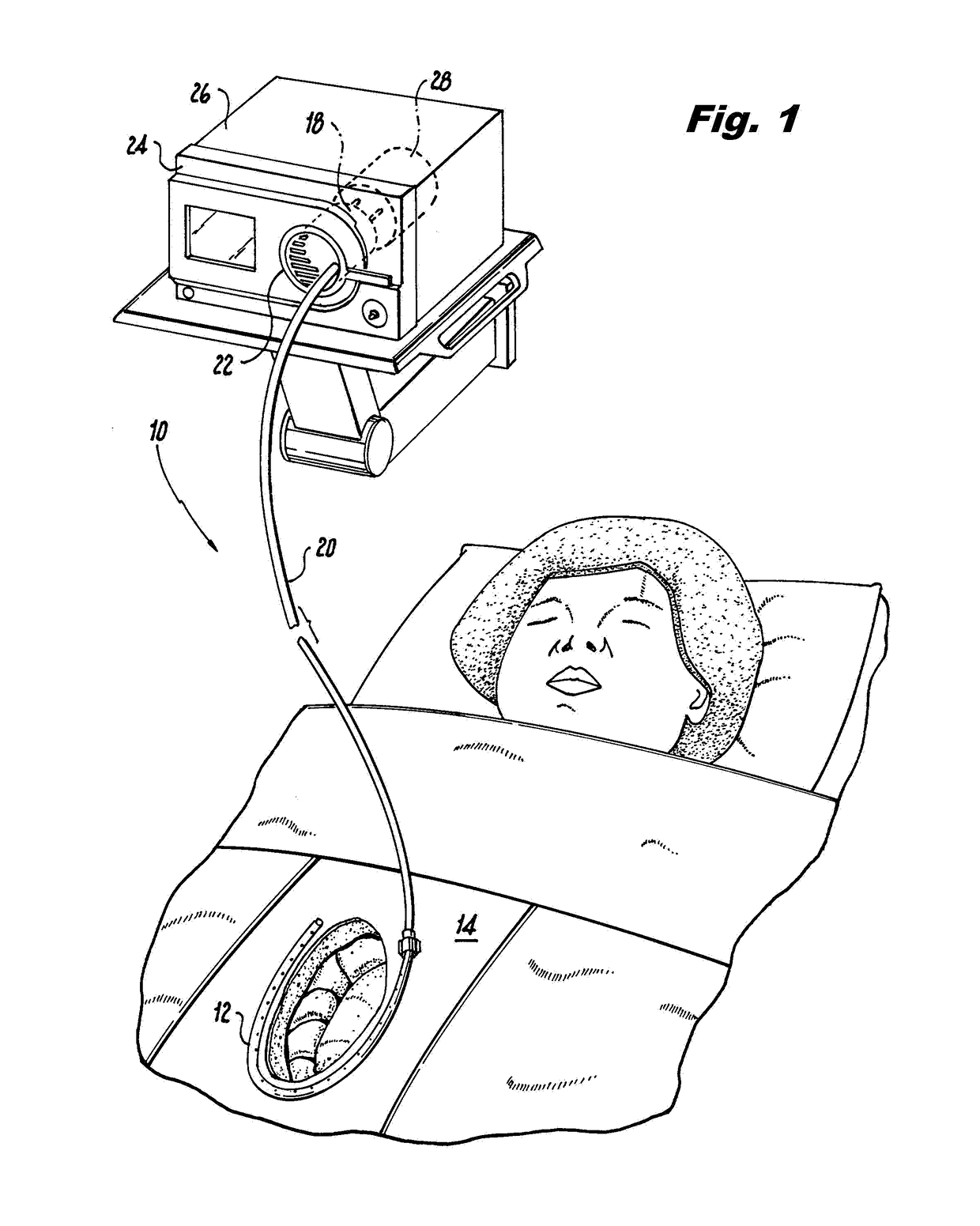 Smoke evacuation system for invasive surgical procedures