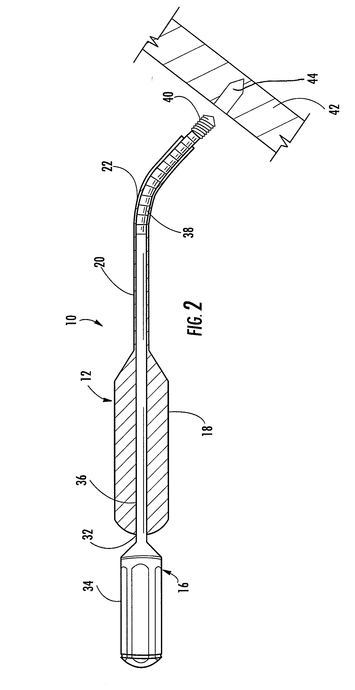 Surgical Anchor Delivery System