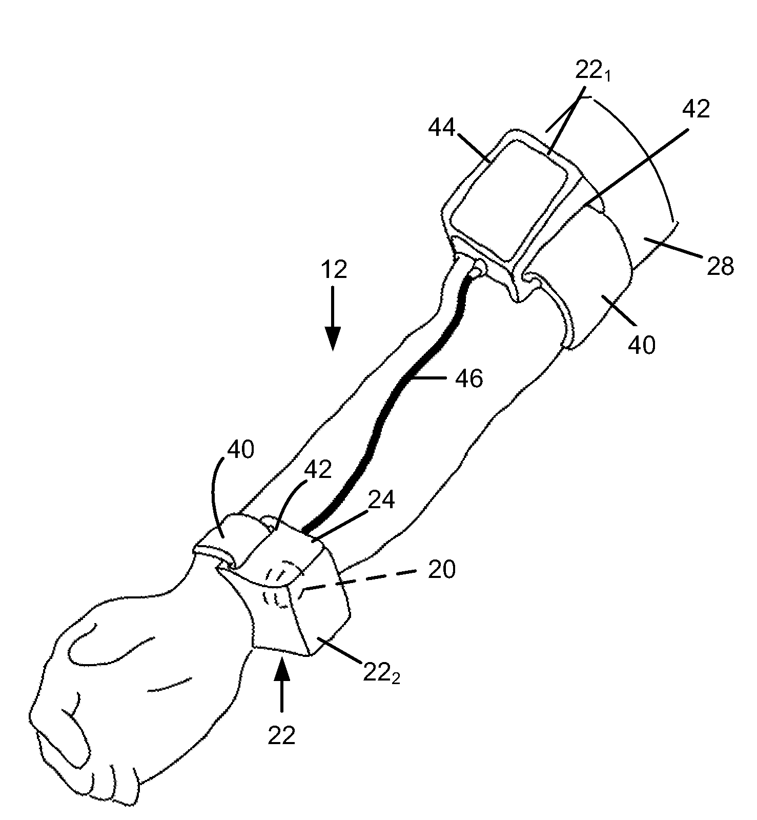 Method and device for reducing symptomatic relapse of spasticity