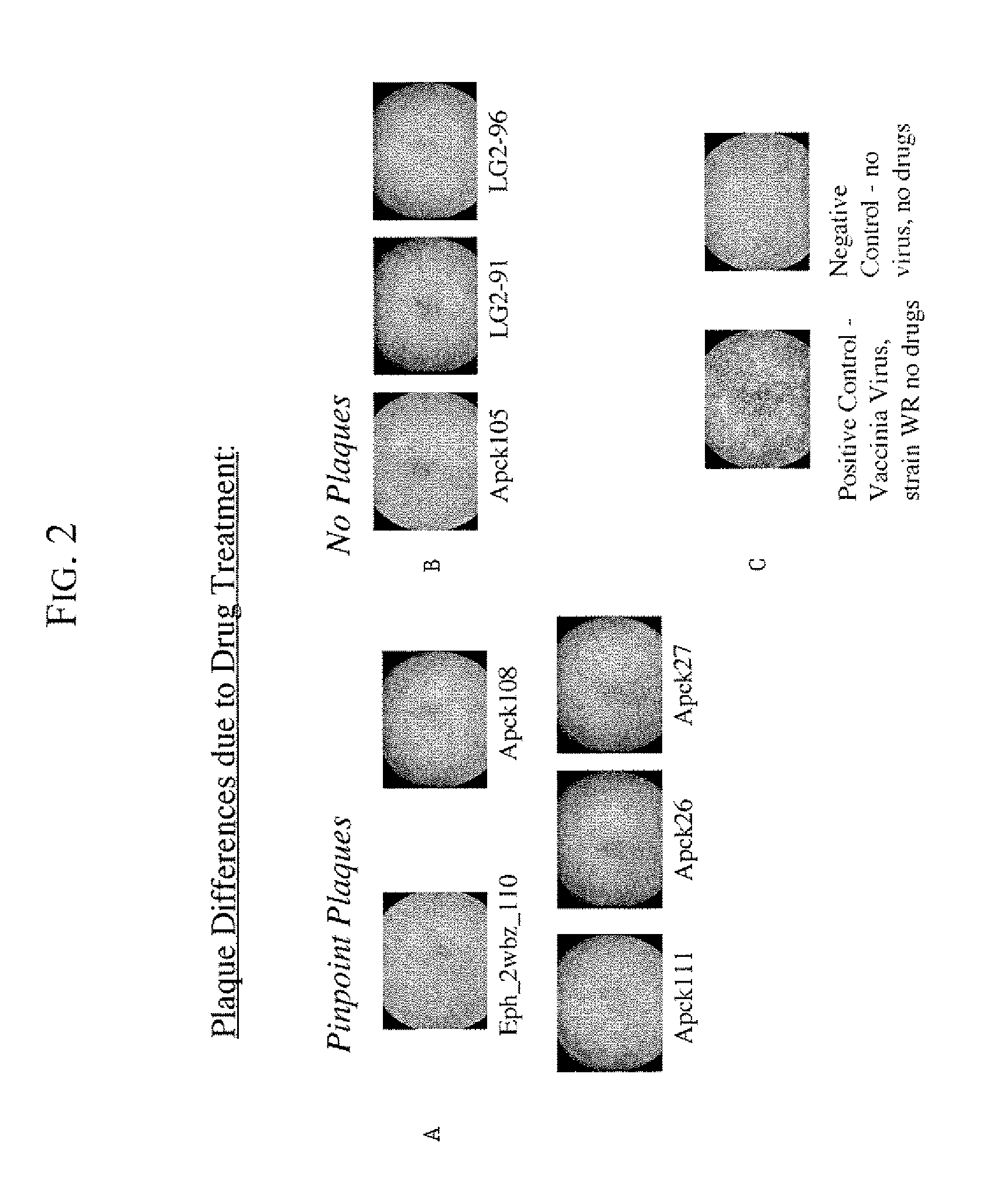 Kinase inhibitors for preventing or treating pathogen infection and method of use thereof