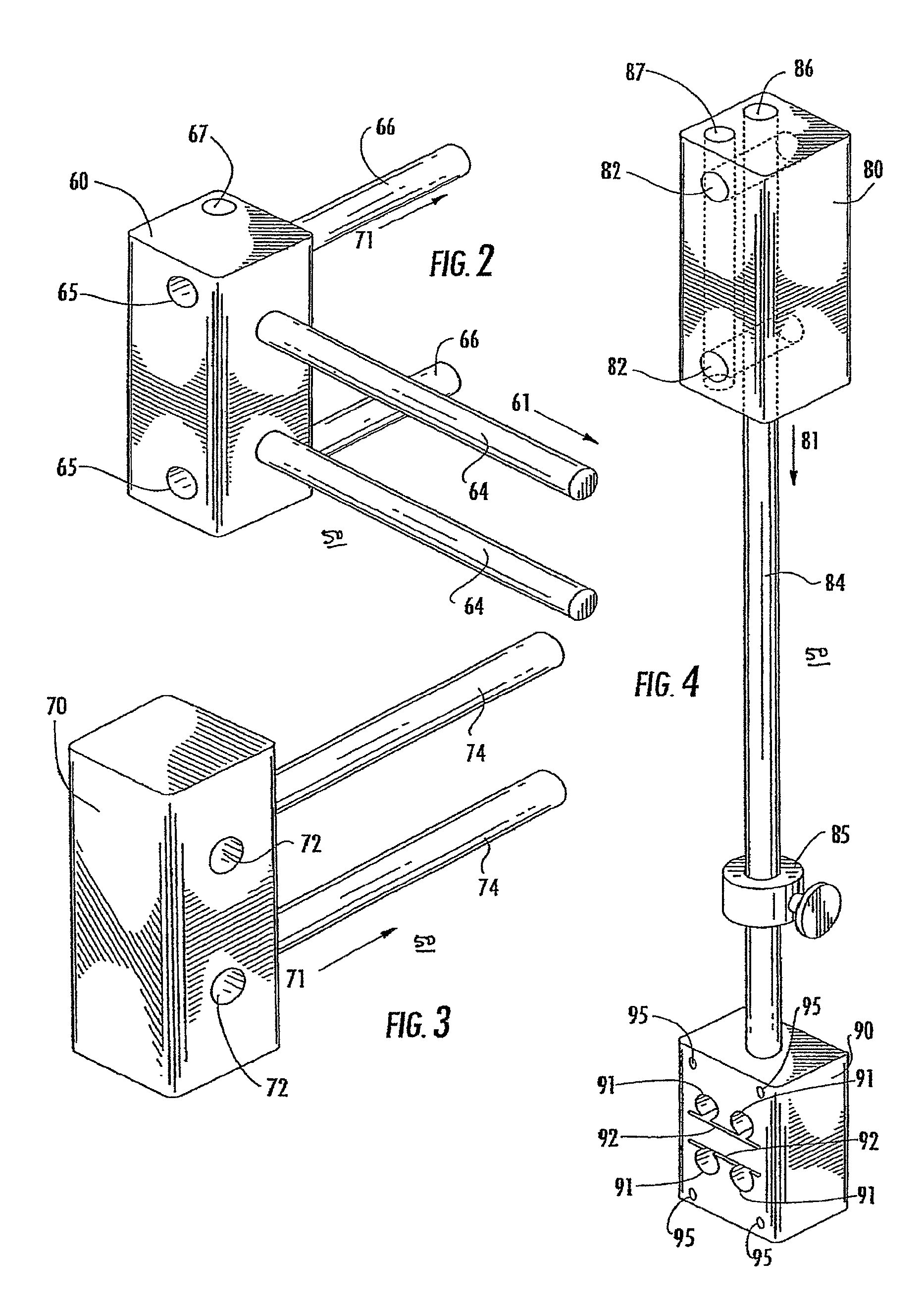 Method of preparing an ankle joint for replacement, joint prosthesis, and cutting alignment apparatus for use in performing an arthroplasty procedure