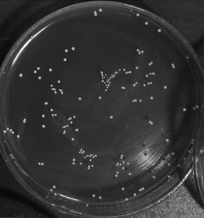 Lactobacillus plantarum with fast acid production and high acid yield and application of lactobacillus plantarum