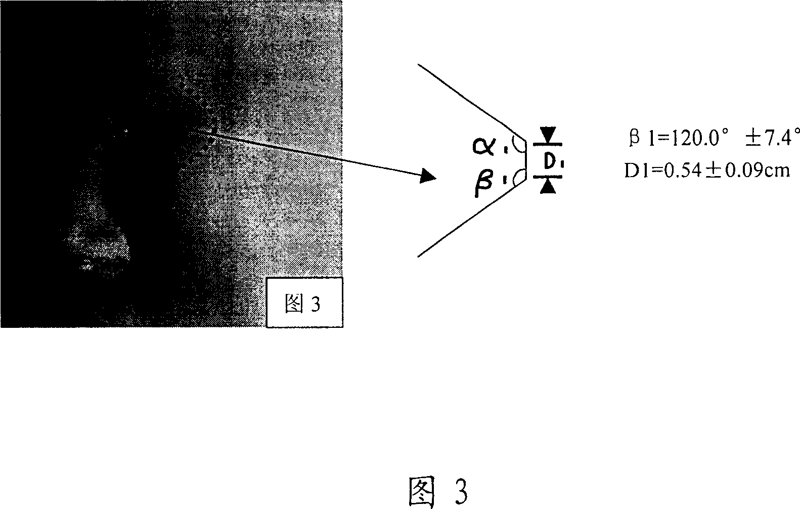 Eye wrinkle-removing film patch