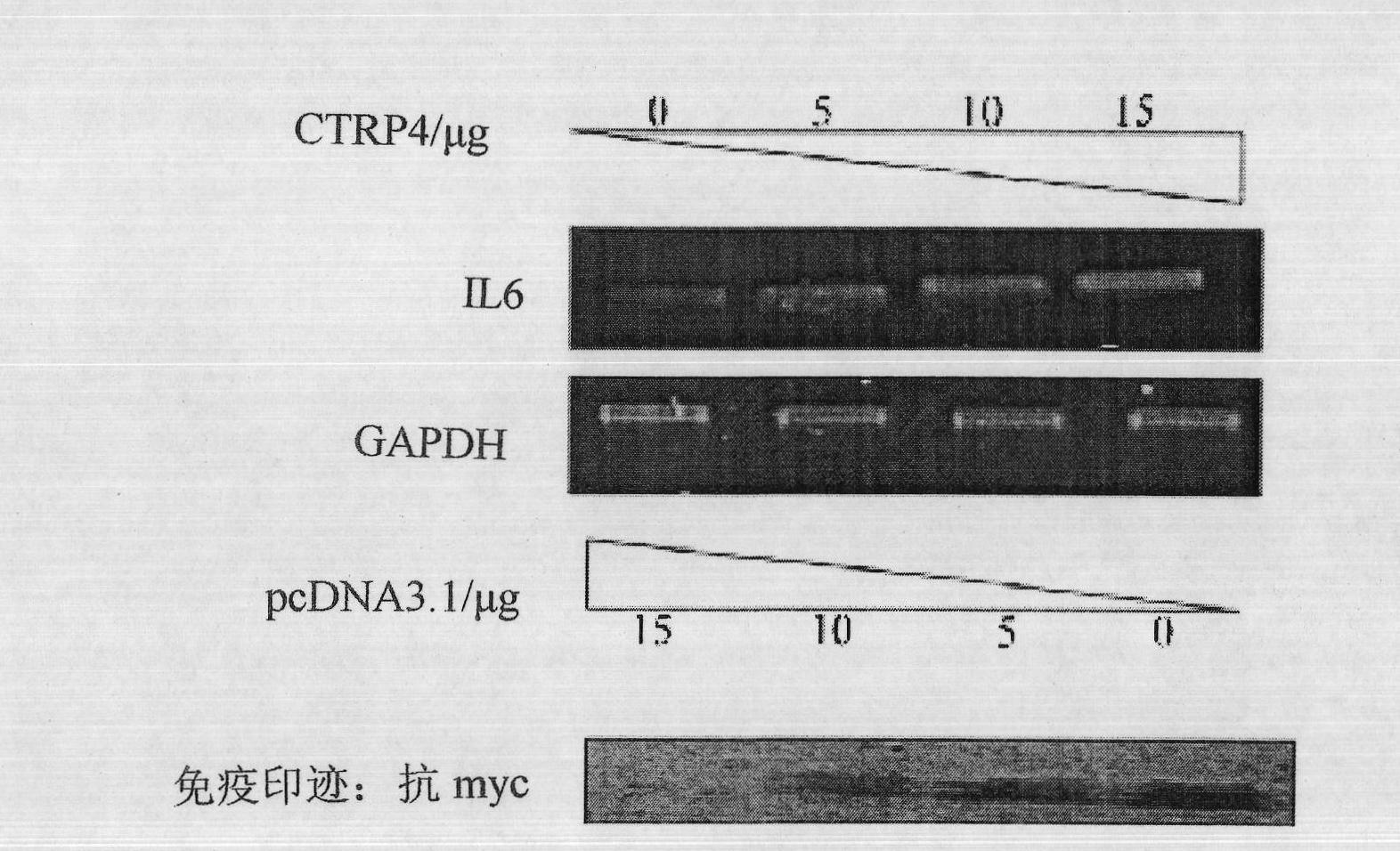 Human CTRP4 gene, its coding protein and their application
