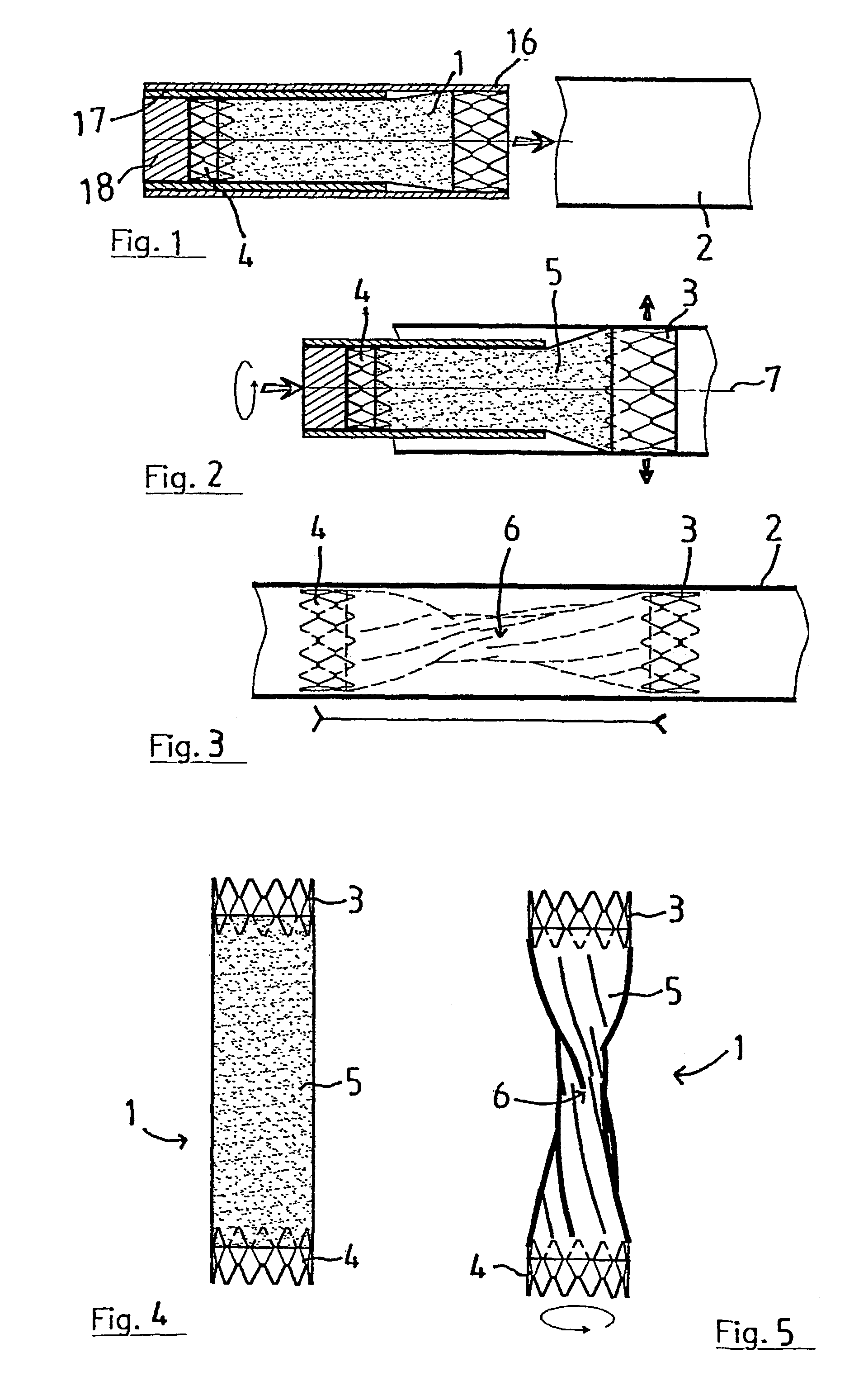 Vascular occlusion device, apparatus and method for using same