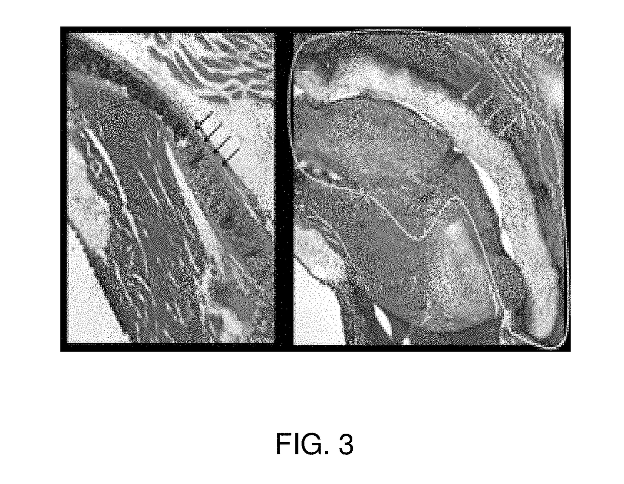 Primed muscle progenitor cells and uses thereof