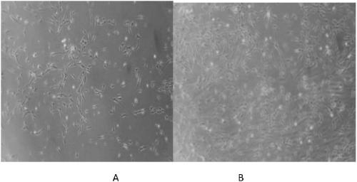 Isolation and culture method of human adipose-derived stem cells and construction method of stem cell bank