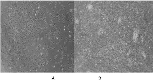 Isolation and culture method of human adipose-derived stem cells and construction method of stem cell bank