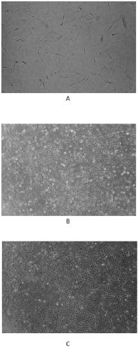 Isolation and culture method of human adipose-derived stem cells and construction method of stem cell bank