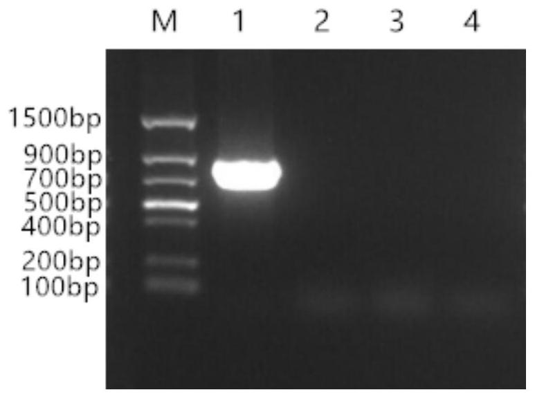 PCR specific primer and detection method for detecting Sanguilla anguilla