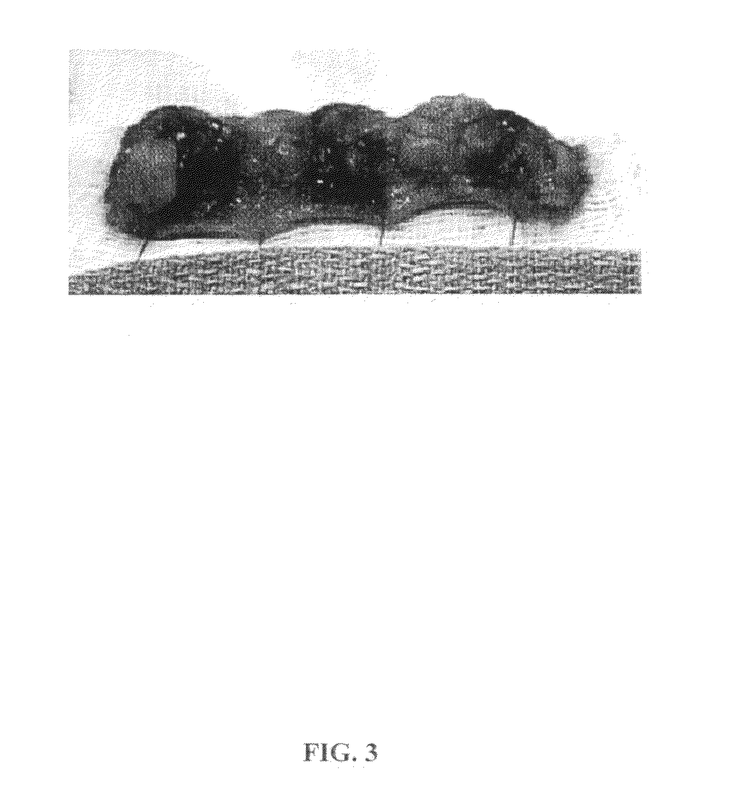 Compositions and methods to reduce fat and retract skin