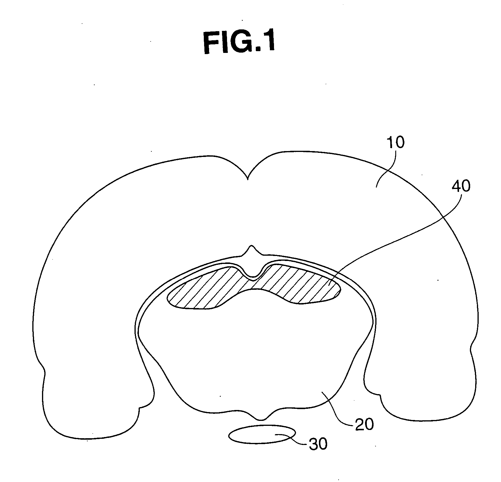Rodent with urinary disturbance and method of constructing the same, and method of screening remedy for urinary disturbance using the rodent
