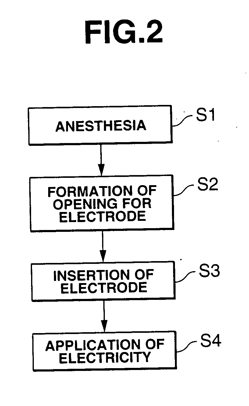 Rodent with urinary disturbance and method of constructing the same, and method of screening remedy for urinary disturbance using the rodent