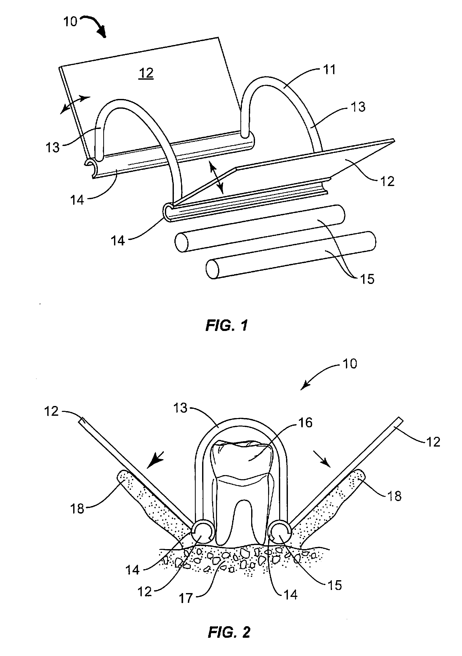 Reflected gingival tissue retractor device for surgical dental procedures, kit and method for use thereof