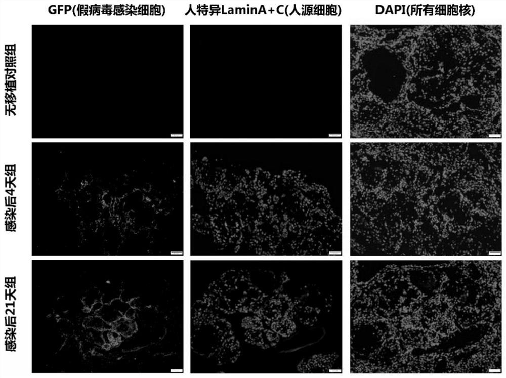 Construction method and application of rodent model of novel coronavirus infection