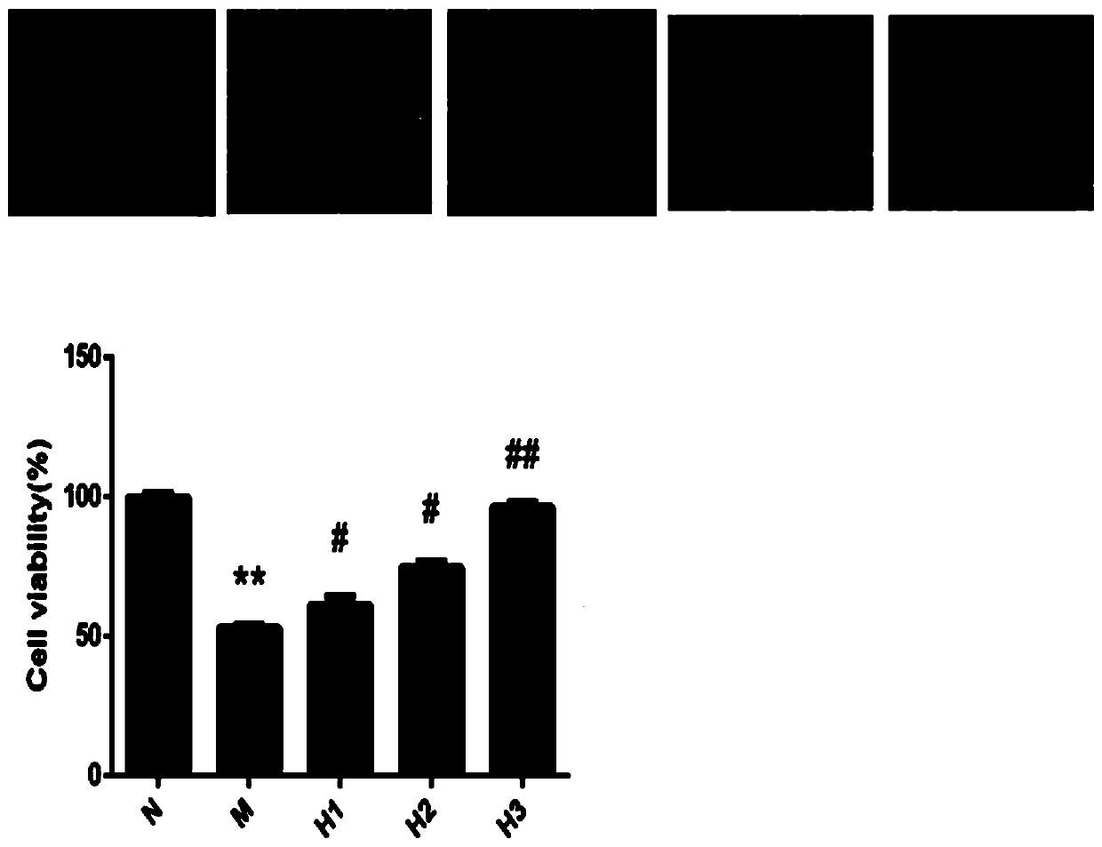 Medical use of hyperin in relieving of human aortic endothelial cell injury