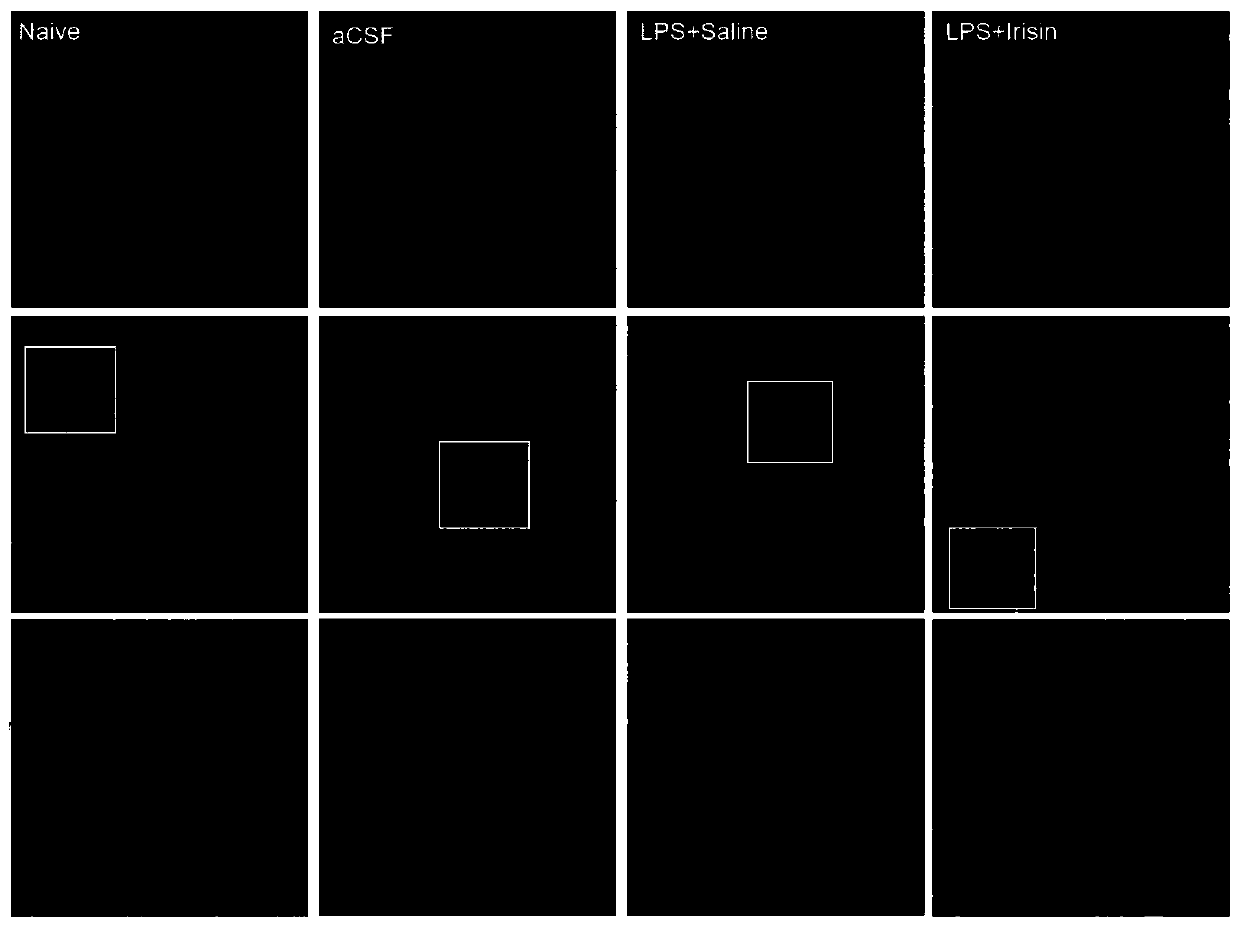 Application of irisin for preparing medicine for preventing and treating postoperative cognition impairment and blood brain barrier damaged mediated encephalopathy