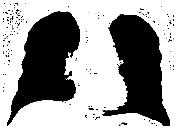 A method and device for segmenting lung lobes based on CT images