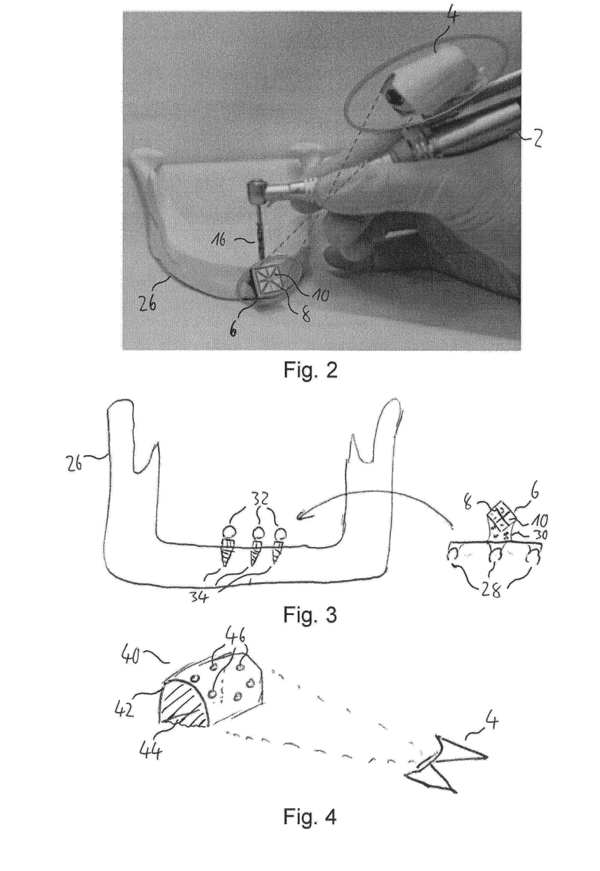 Navigation system and method for dental and cranio-maxillofacial surgery, positioning tool and method of positioning a marker member