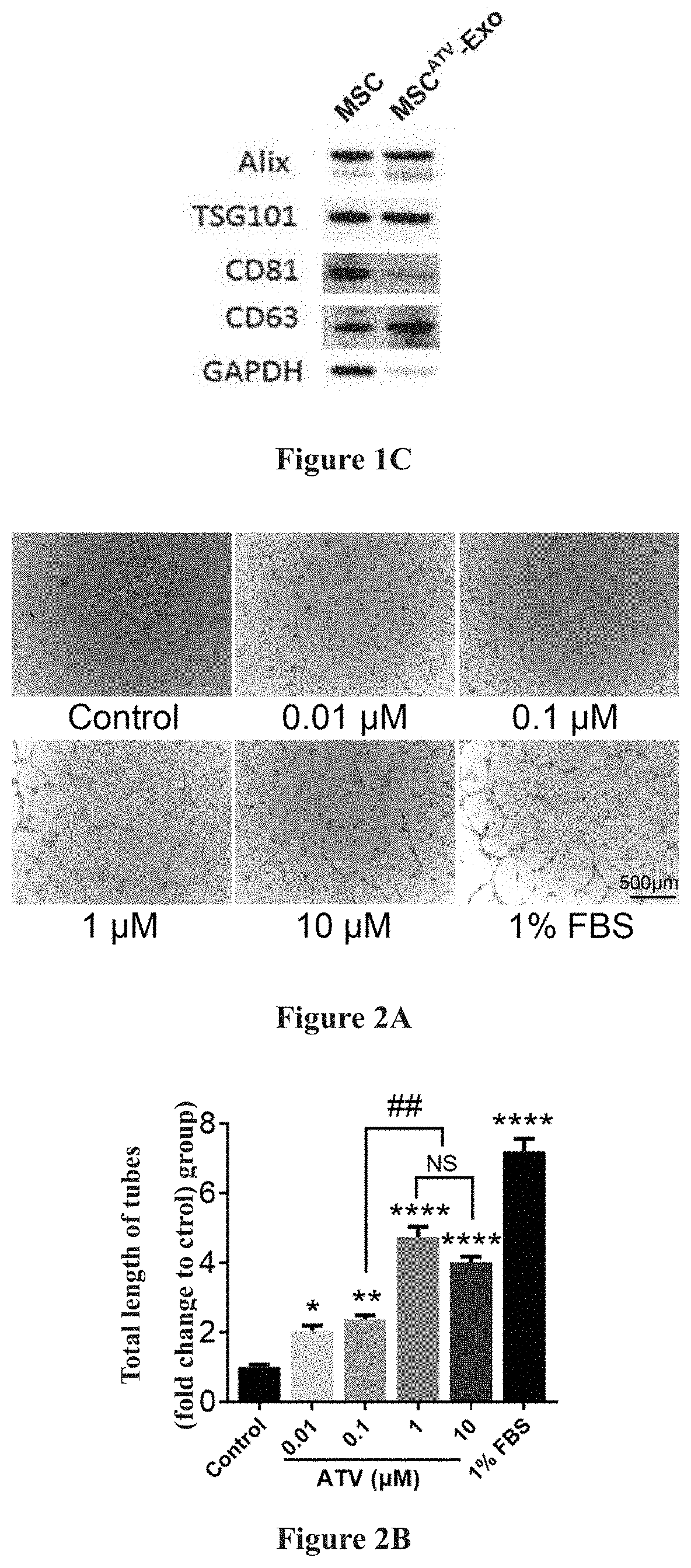 Preparation method of mesenchymal stem cell-derived exosomes based on drug pretreatment