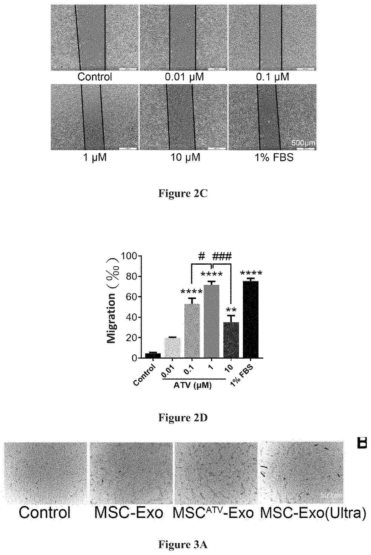 Preparation method of mesenchymal stem cell-derived exosomes based on drug pretreatment