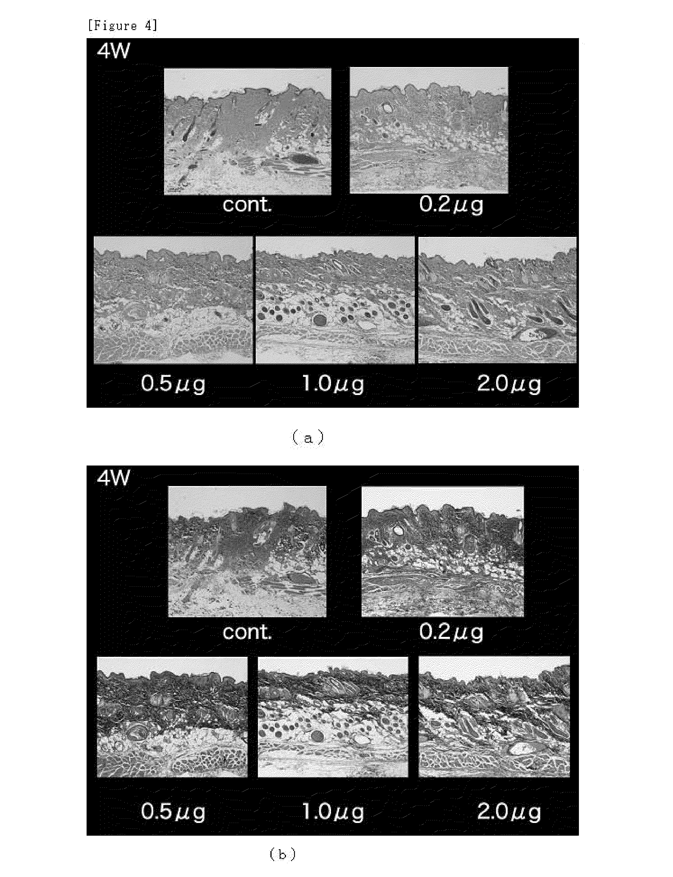 Microneedle assembly formulation for skin treatment