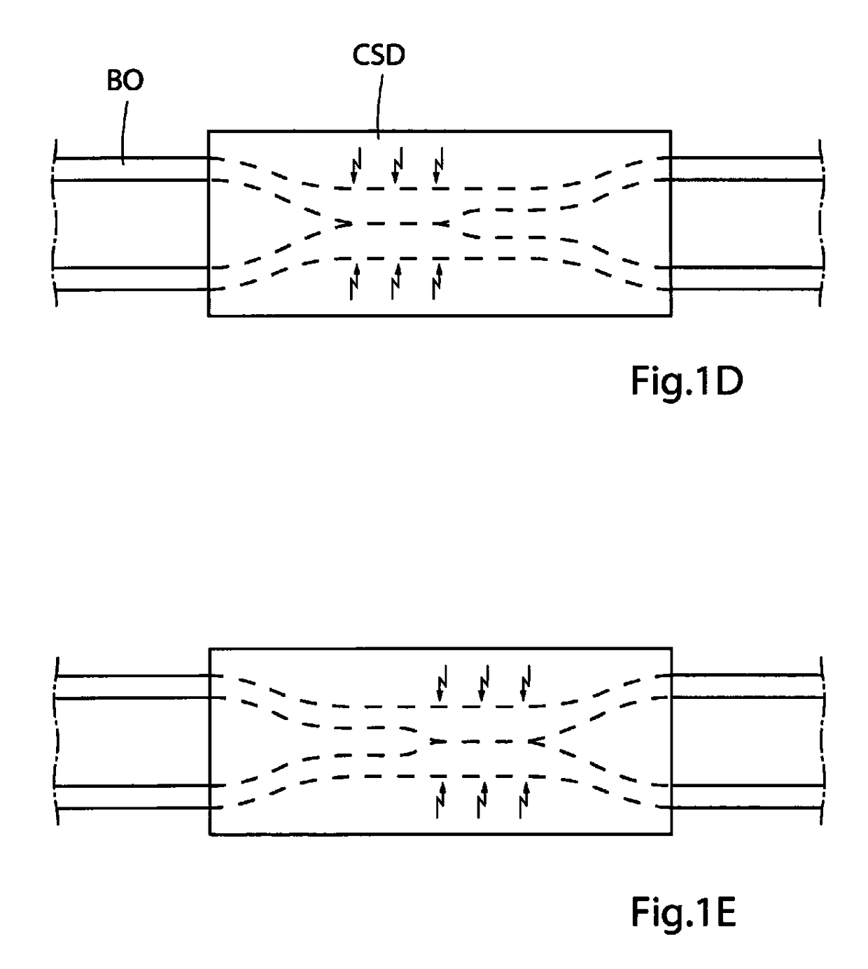 Method for controlling flow in a bodily organ