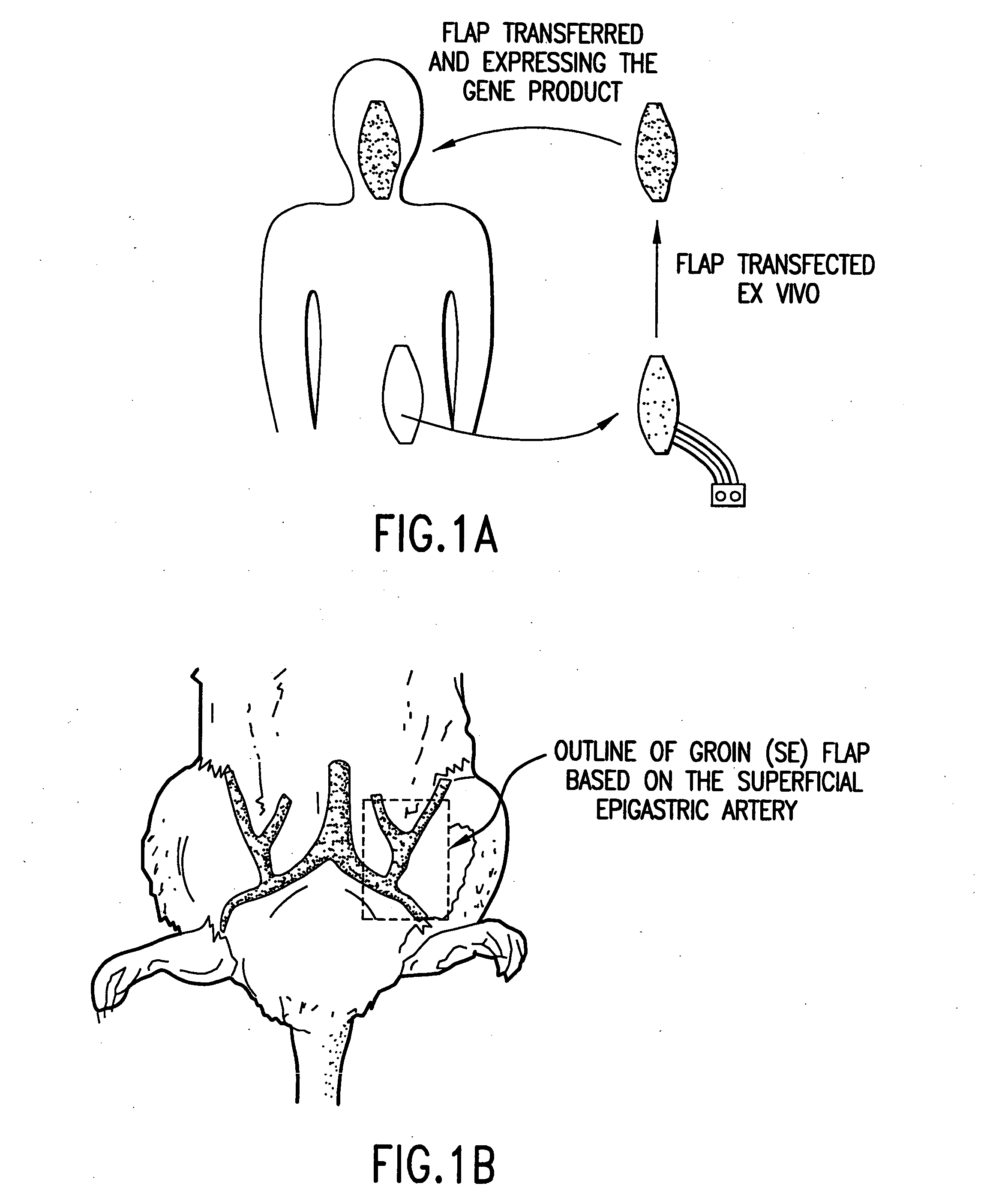 Microvascular free flaps for local or systemic delivery