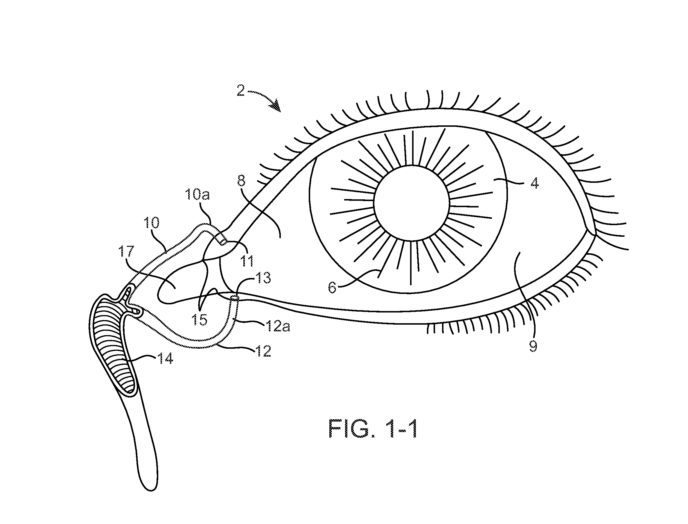 Drug Delivery Methods, Structures, and Compositions for Nasolacrimal System