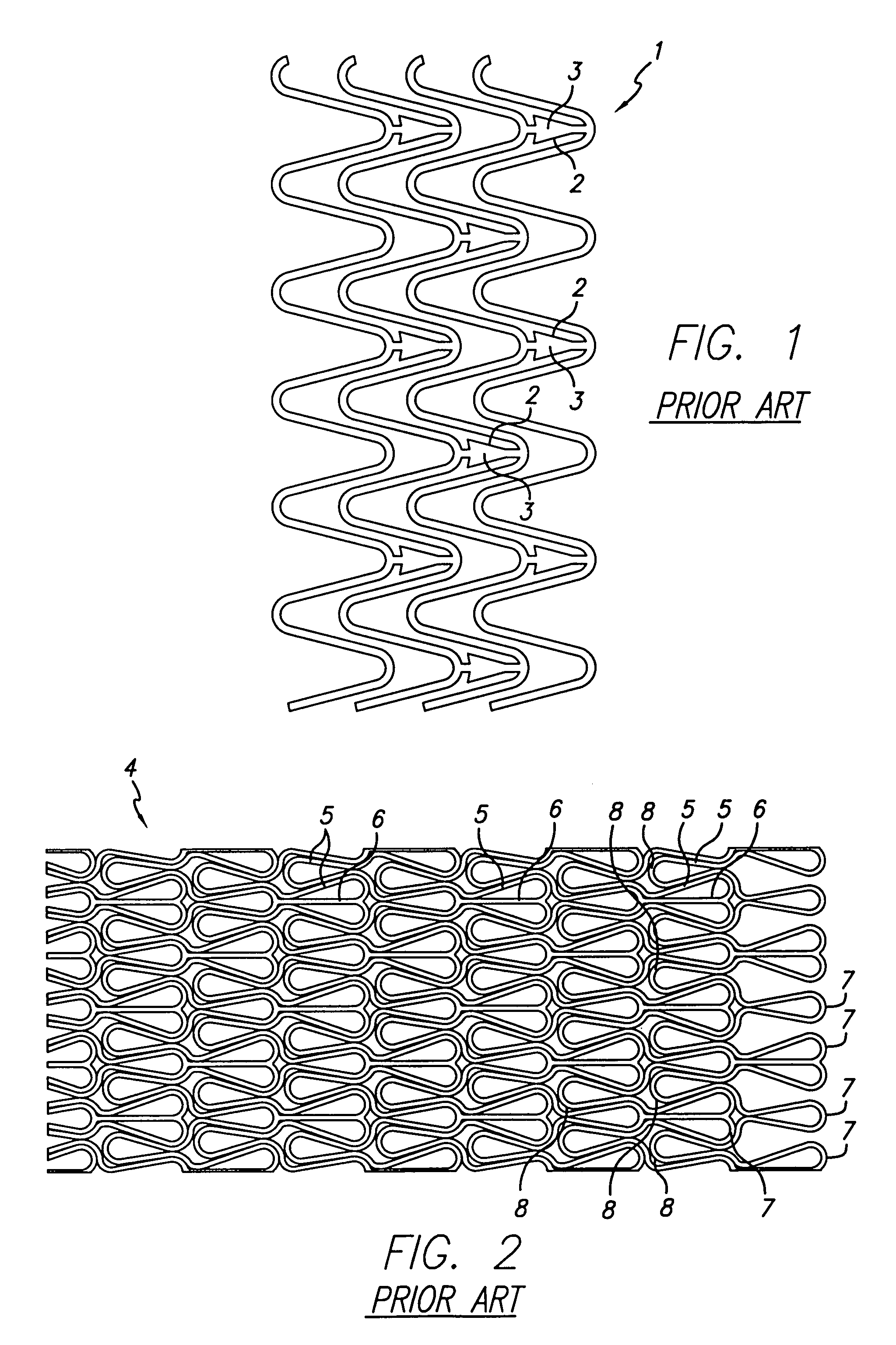 Apparatus and method for decreasing stent gap size