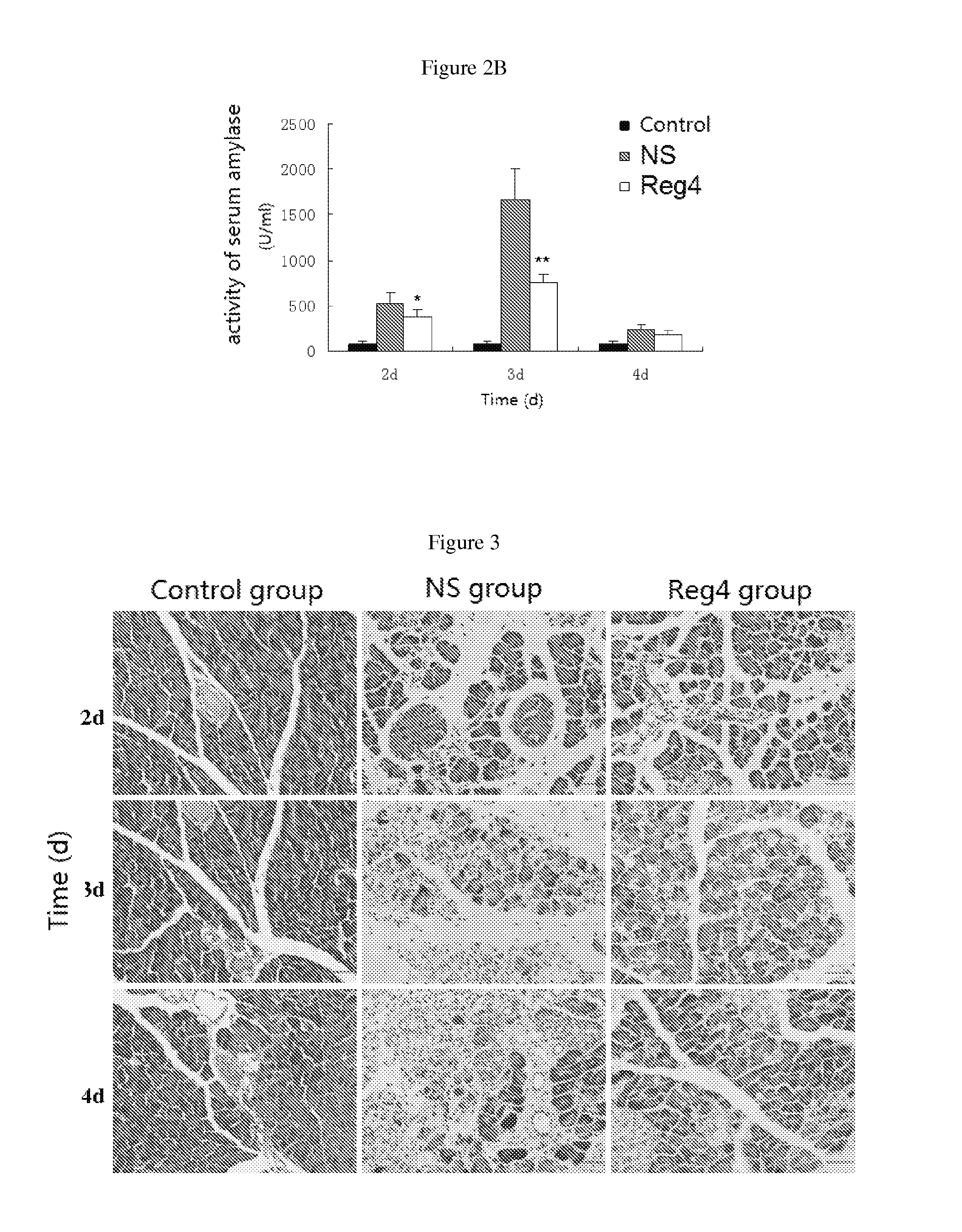 Use of reg4 and pharmaceutical composition thereof