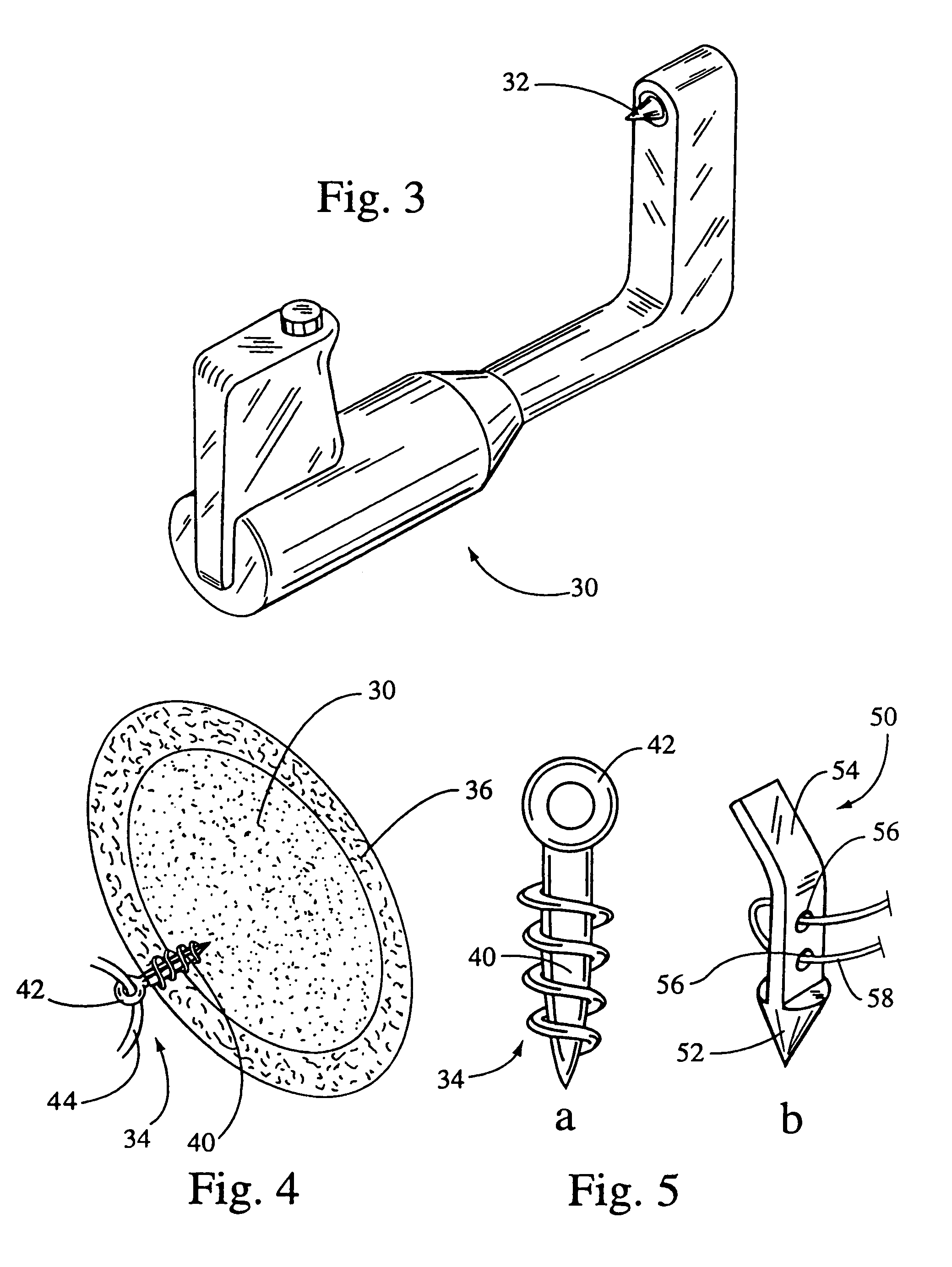 System and method for securing implants to soft tissue