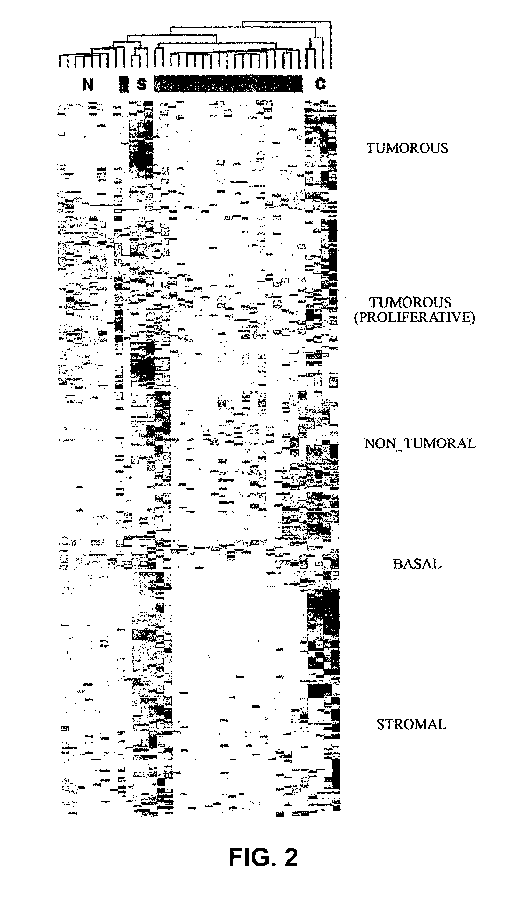 Method for the Molecular Diagnosis of Prostate Cancer and Kit for Implementing Same