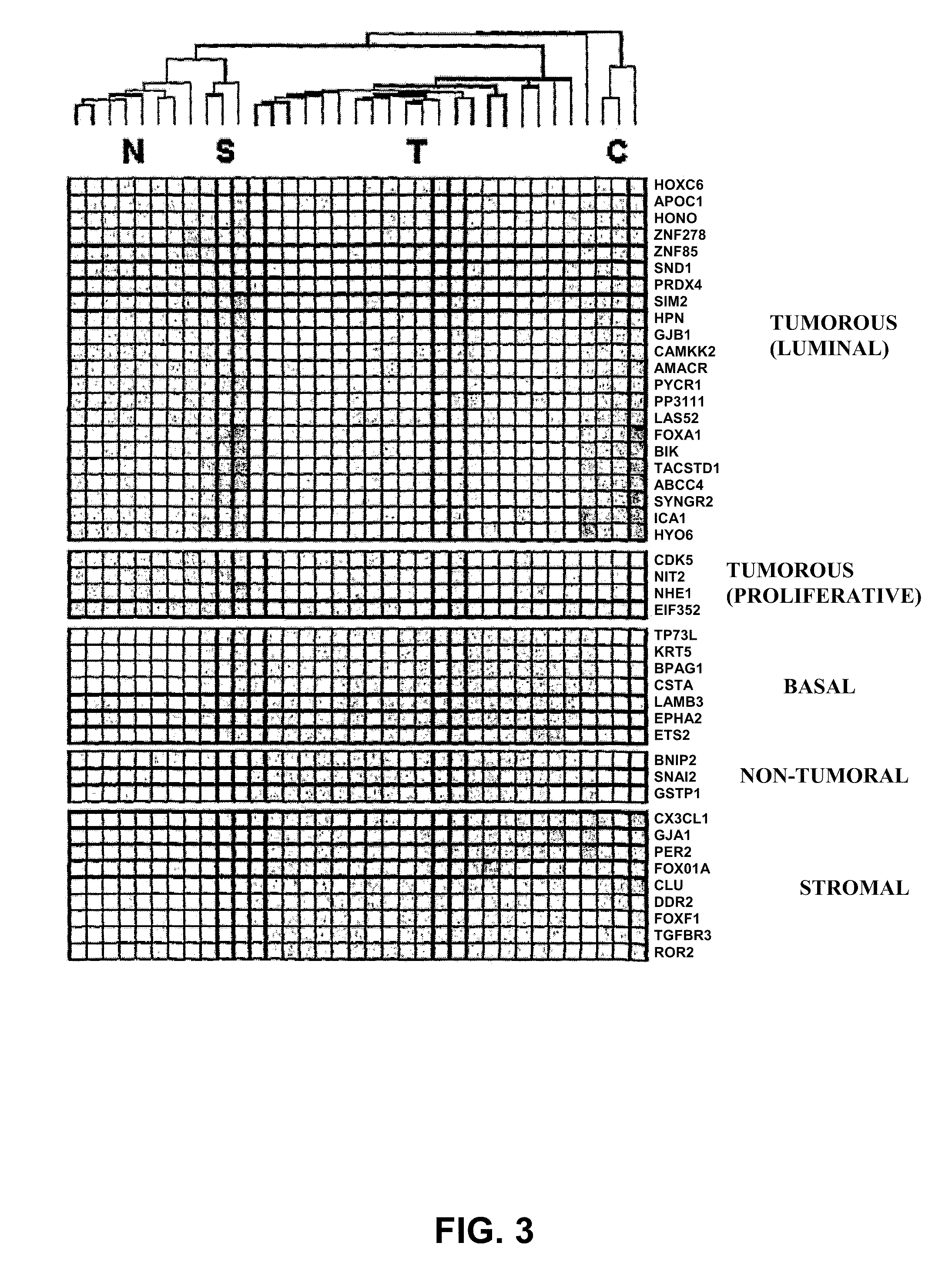 Method for the Molecular Diagnosis of Prostate Cancer and Kit for Implementing Same