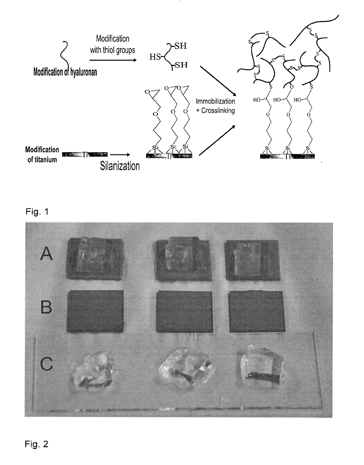 Intraocular device and method for preparing the same