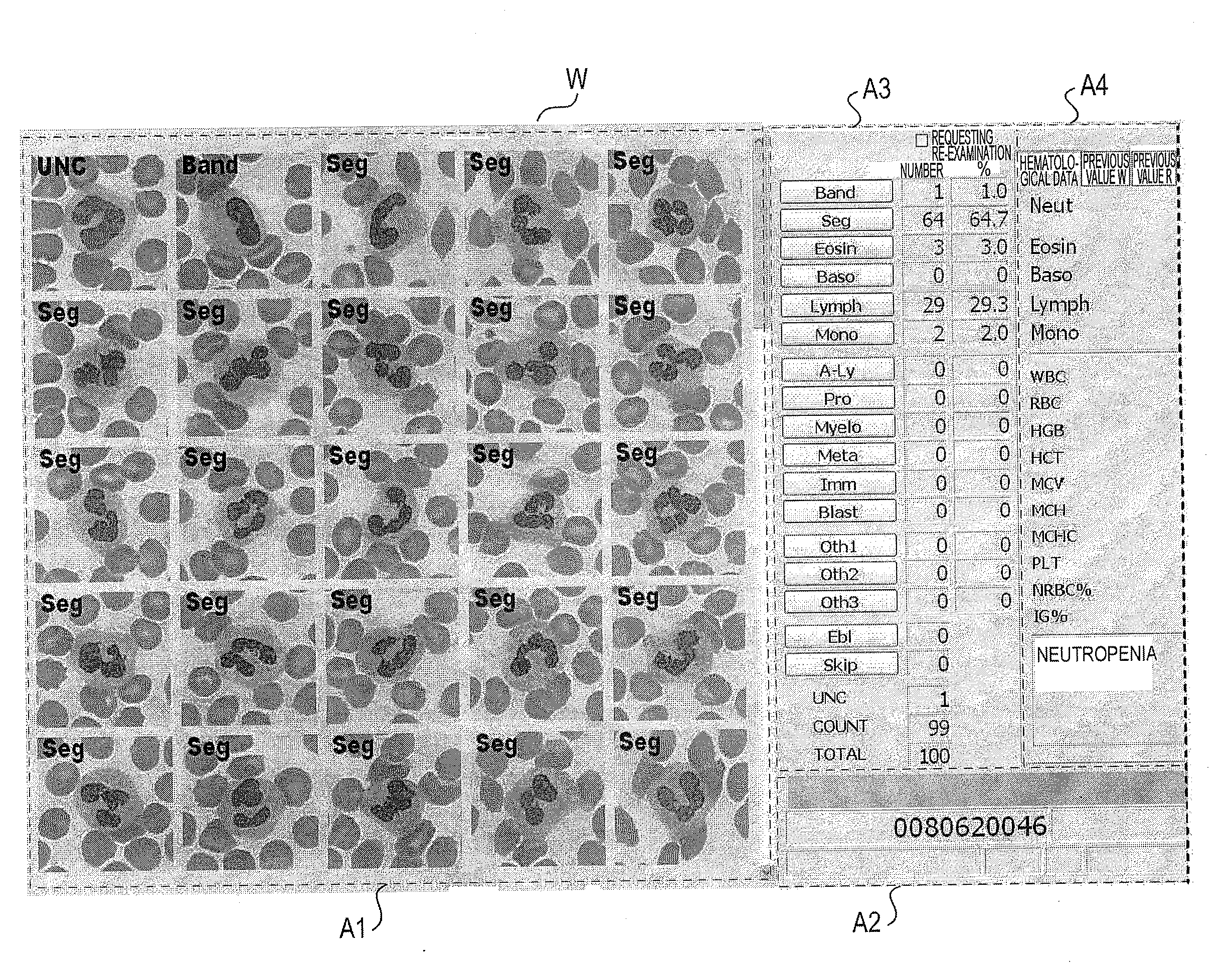 Blood cell image display apparatus, specimen analyzing system, blood cell image display method and computer program product
