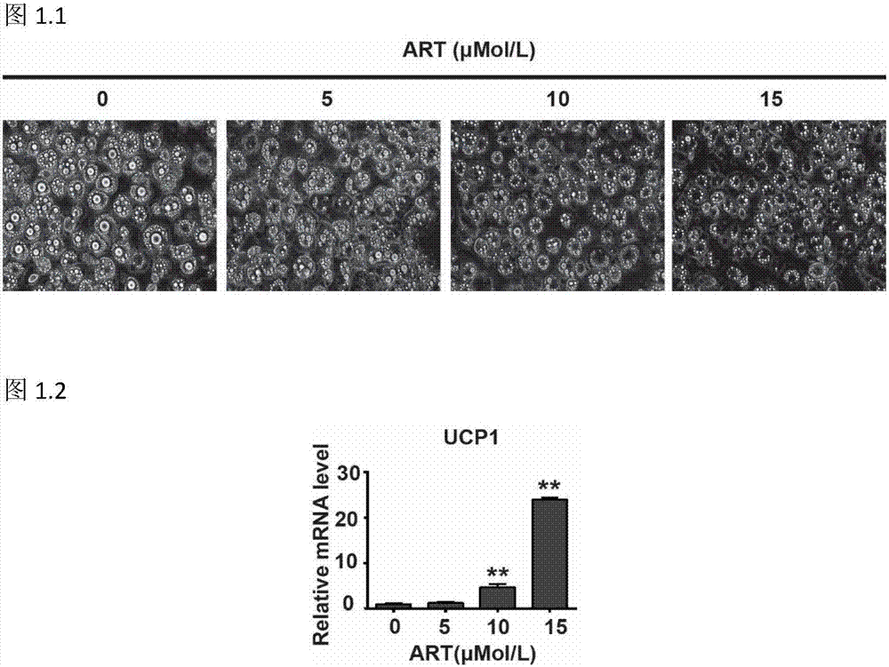 Uses of artemether in preparation of preparations promoting steatolysis and improving carbohydrate metabolism