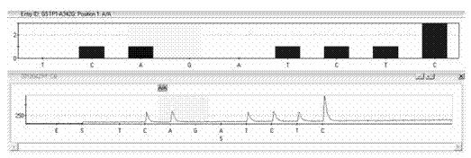 Kit for detecting glutathione S-transferase pi 1 (GSTP1) gene polymorphism by using pyrosequencing method and method