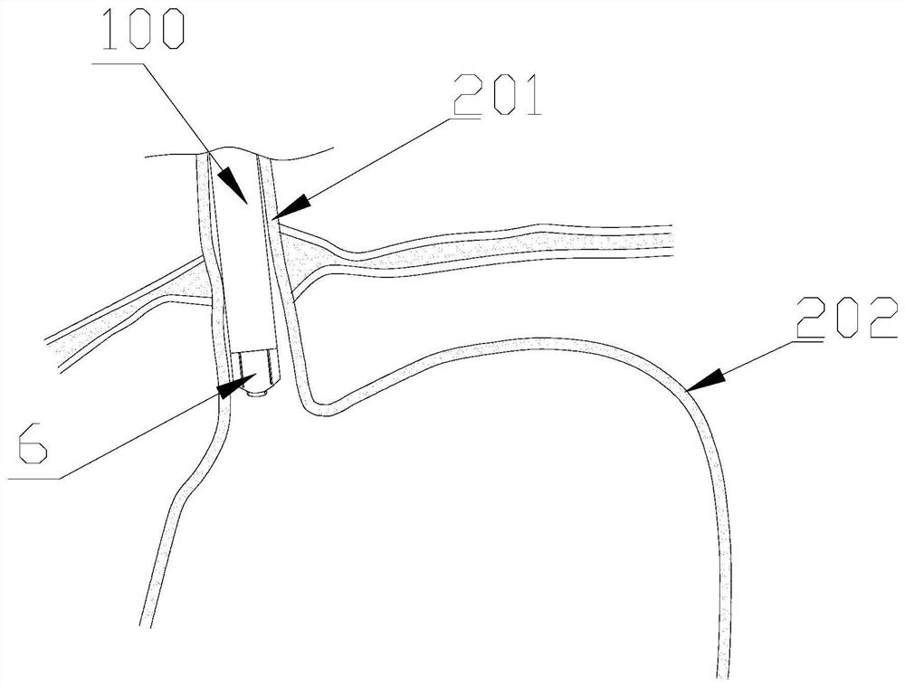 Rigid section of endoscopic nailing device for implementing fundus gastrostomy