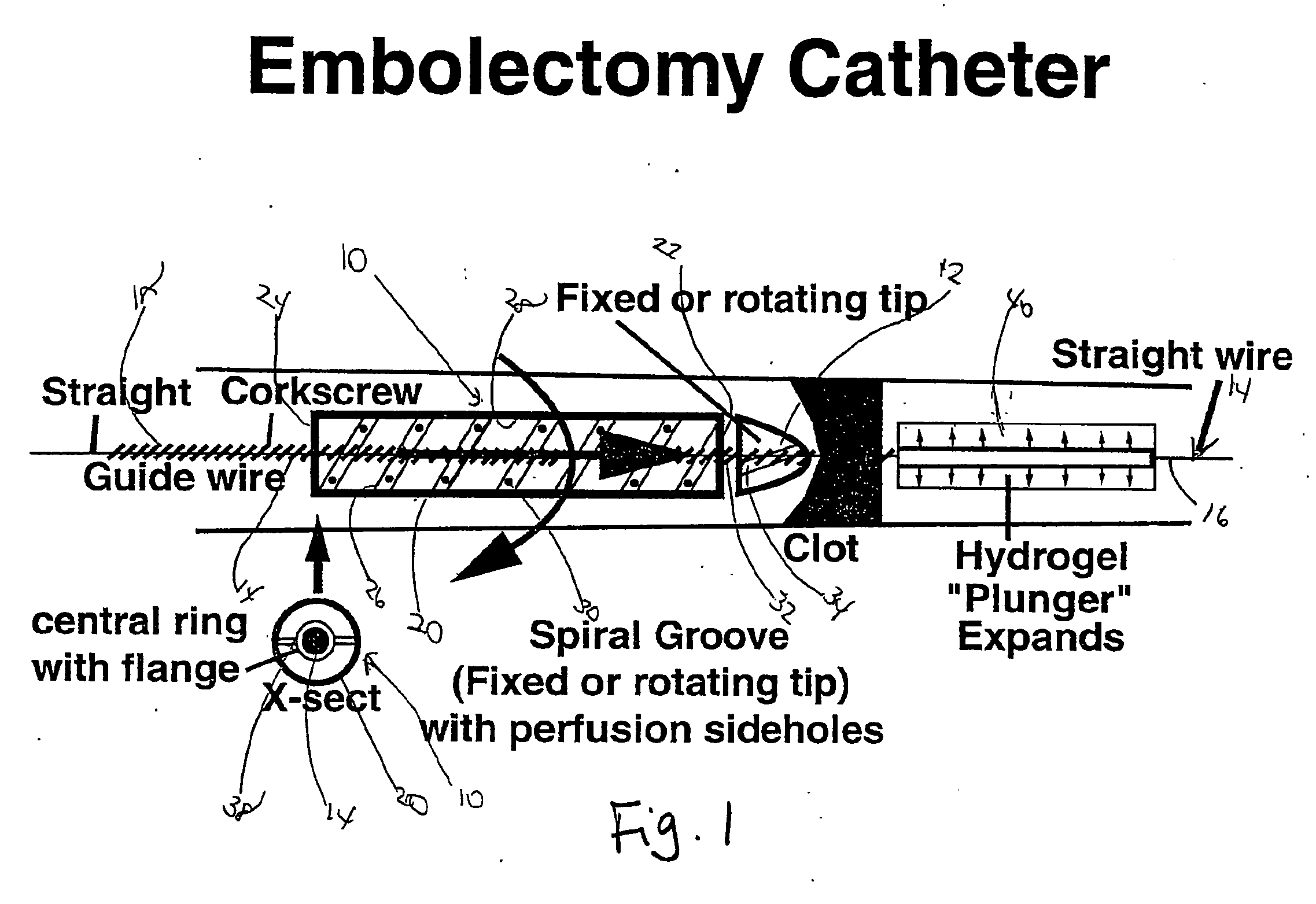 Embolectomy Catheter