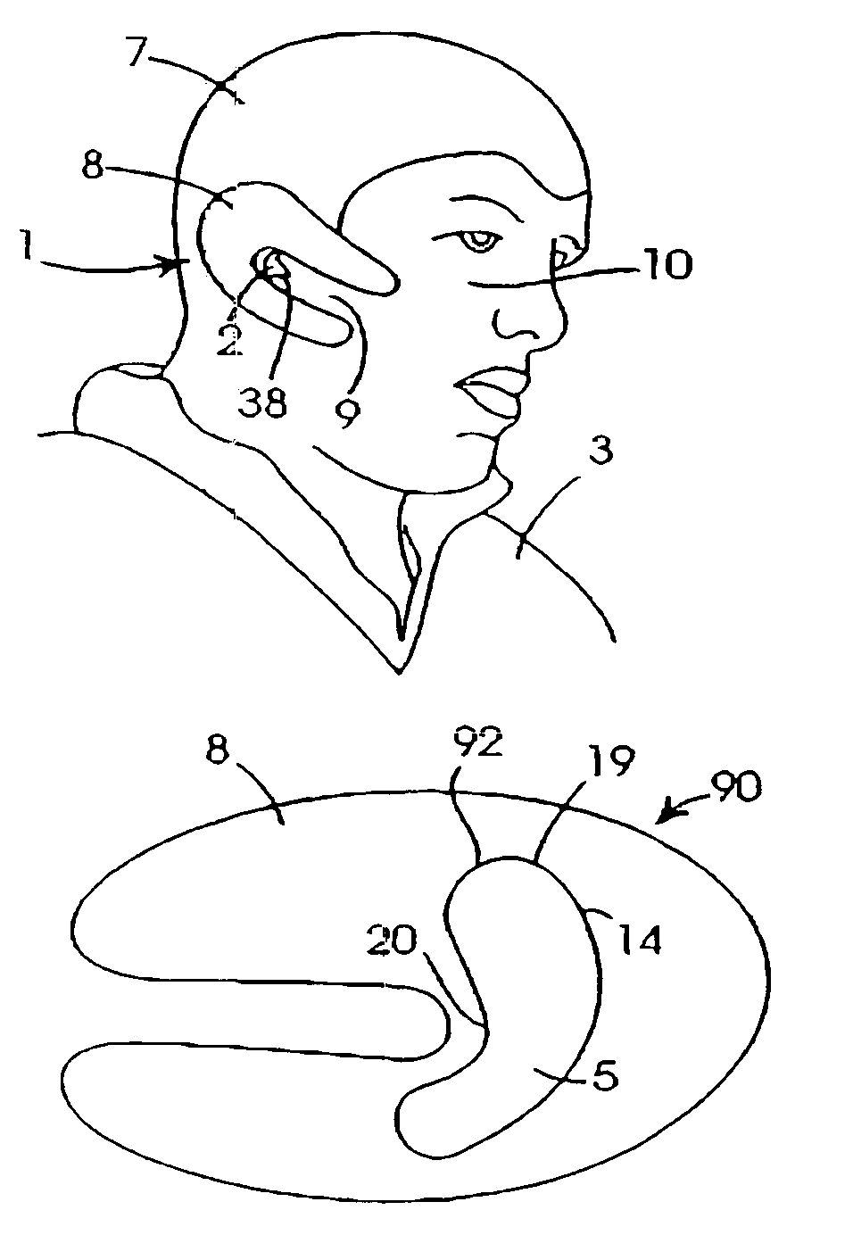 Device and method for protecting an ear of a subject from auricular haematoma
