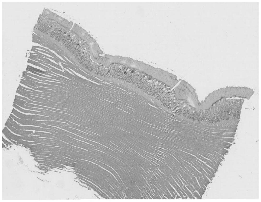 Feed additive for preventing inflammation of muscular gaster and proventriculitis of broiler chickens