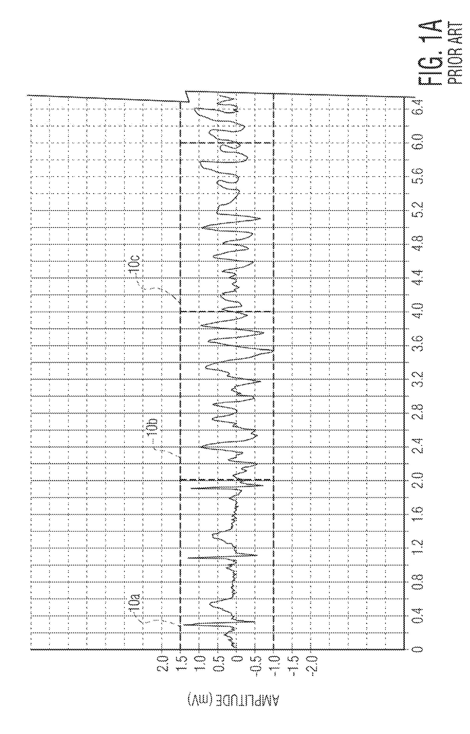 Circuit and method for analyzing a patient's heart function using overlapping analysis windows