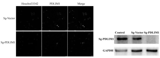 Application of PDLIM 1 in protection of cerebral ischemic neuron injury