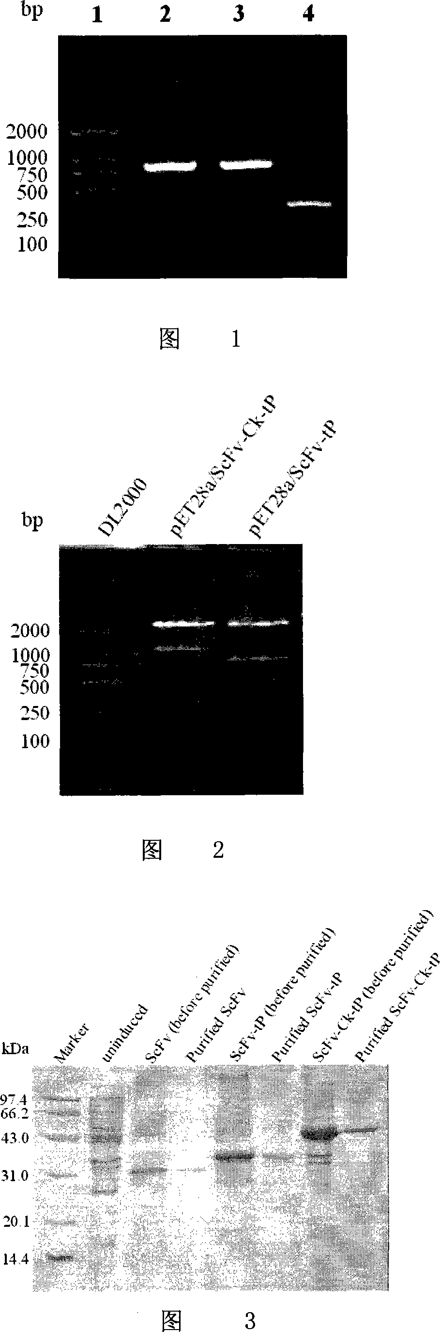 Human anti-HBsAg single-chain antibody/human antibody light chain constant region/protamine truncated recombination gene, coding protein and application