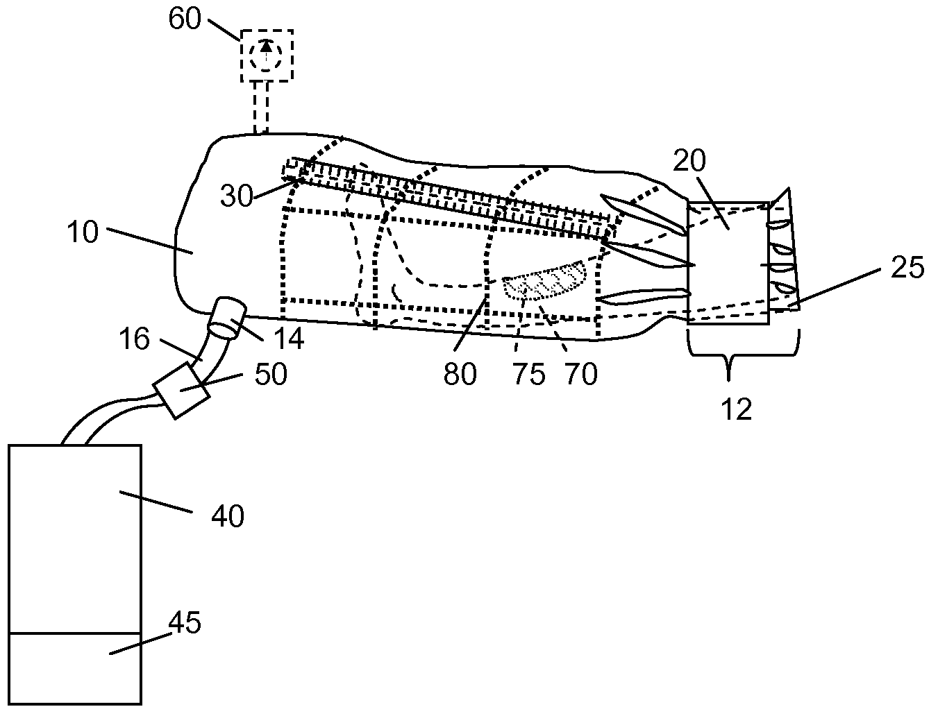 Method and Apparatus for Increasing Blood Flow in a Body Part