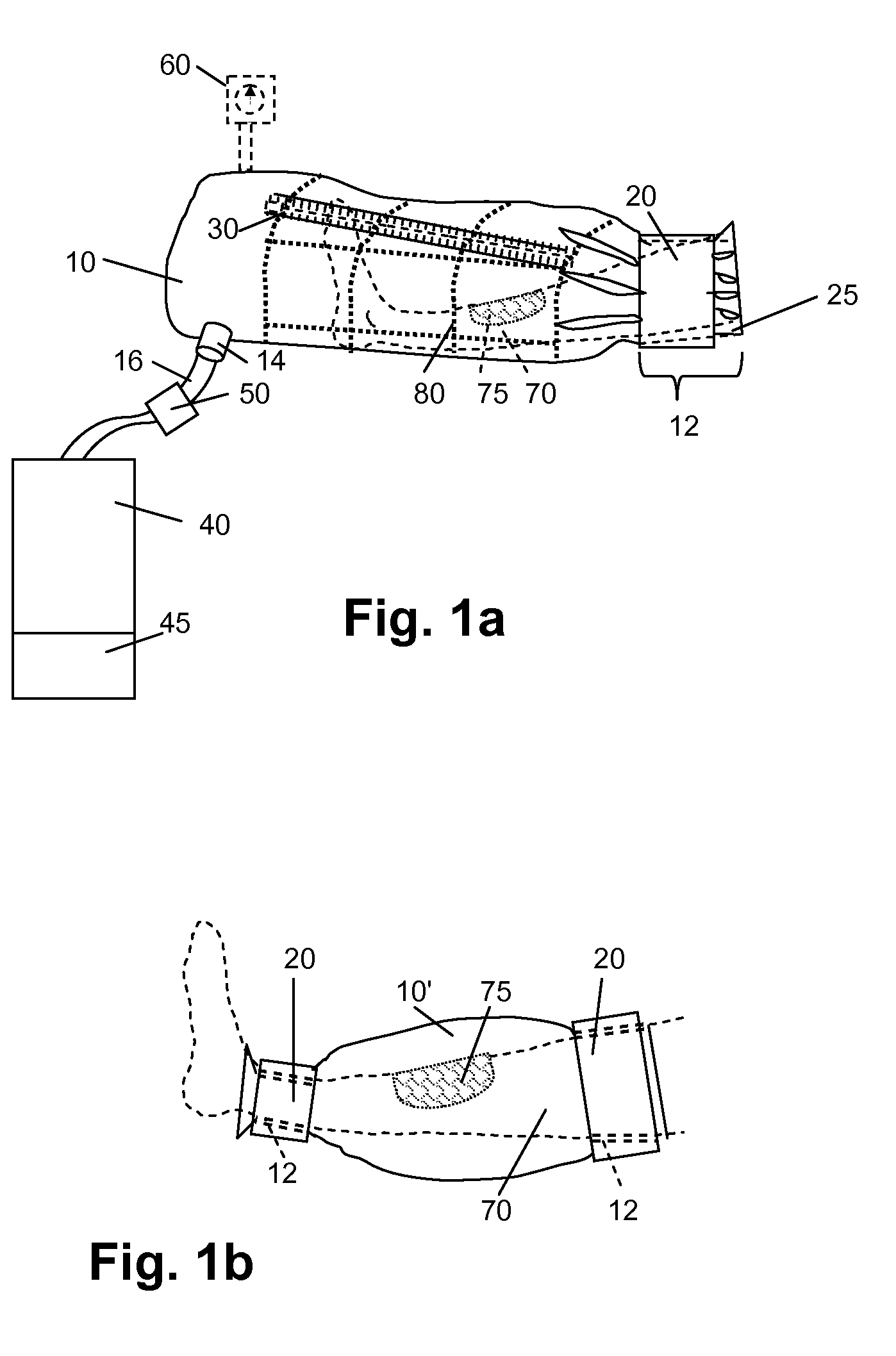 Method and Apparatus for Increasing Blood Flow in a Body Part