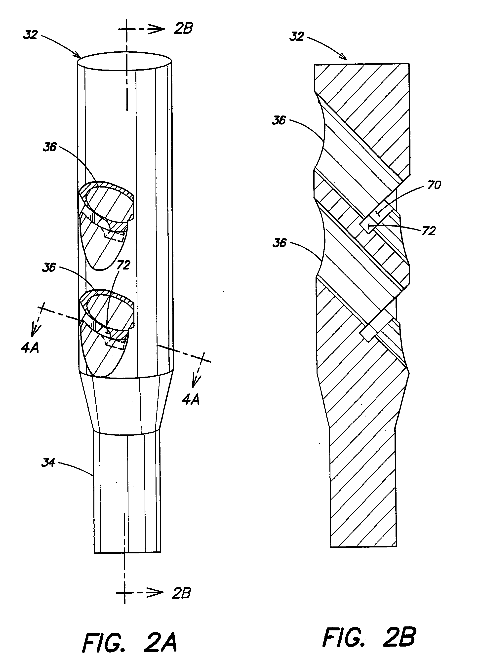 Intramedullary nail system and method for fixation of a fractured bone