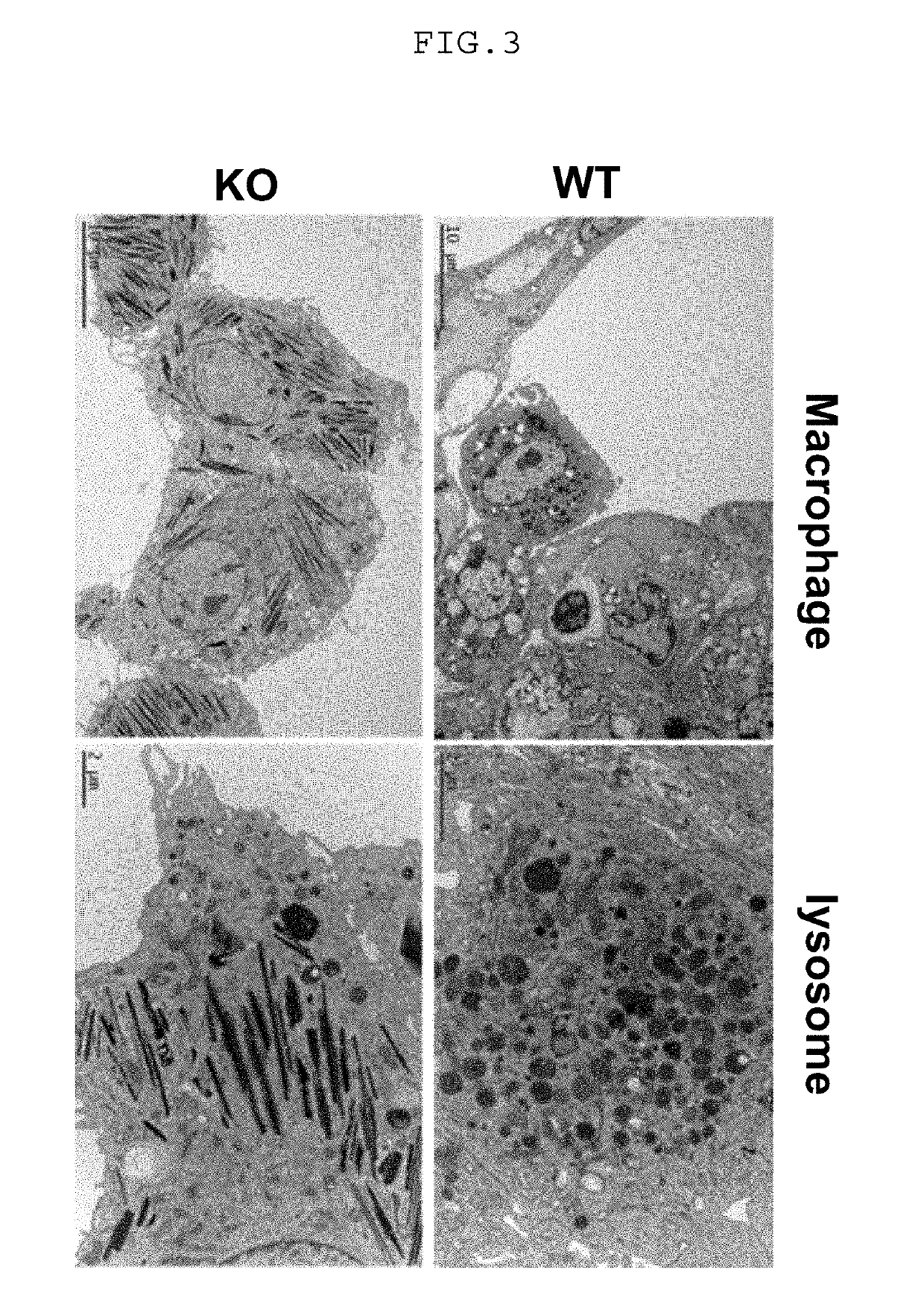 Progranulin (PGRN) and its derivatives for diagnosis and treatment of lysosomal storage diseases