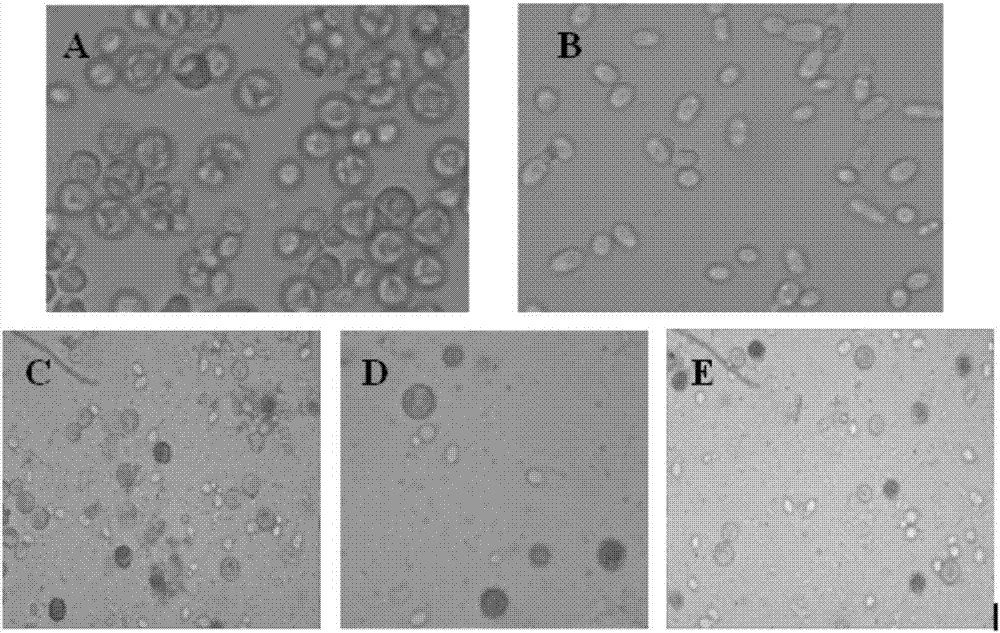 Method of purifying yeast wastewater by co-culture of chlorella and yeast